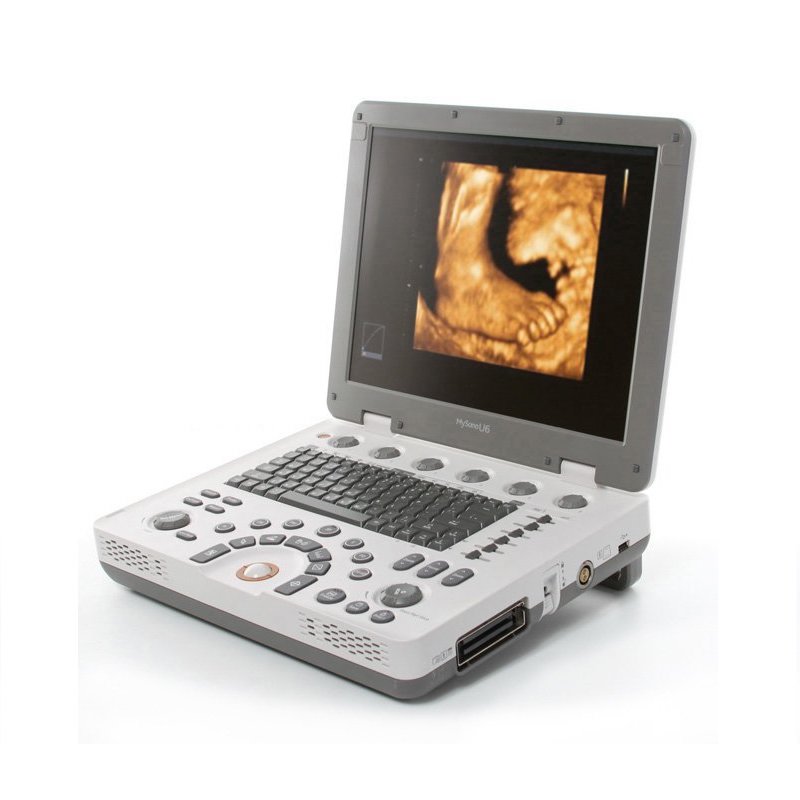 Samsung MySono U6 Ultrasound Machine